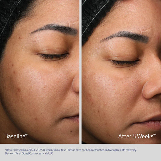 Retinol + PHA Refining Night Cream
